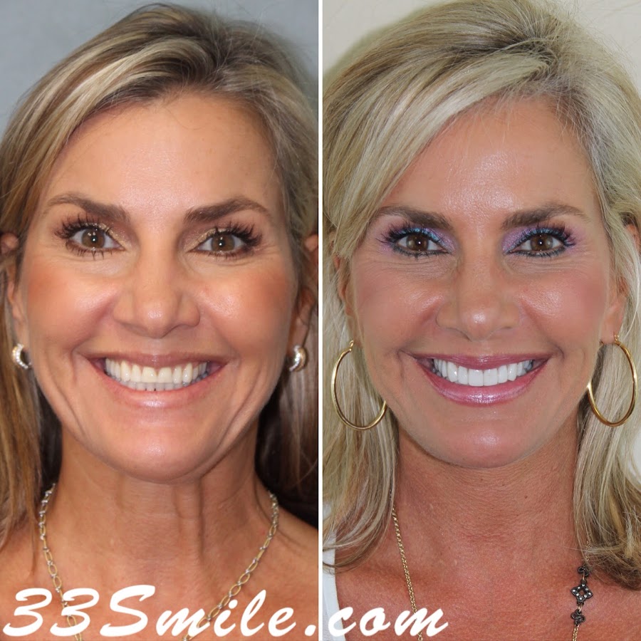 Cosmetic Dental Associates, San Antonio